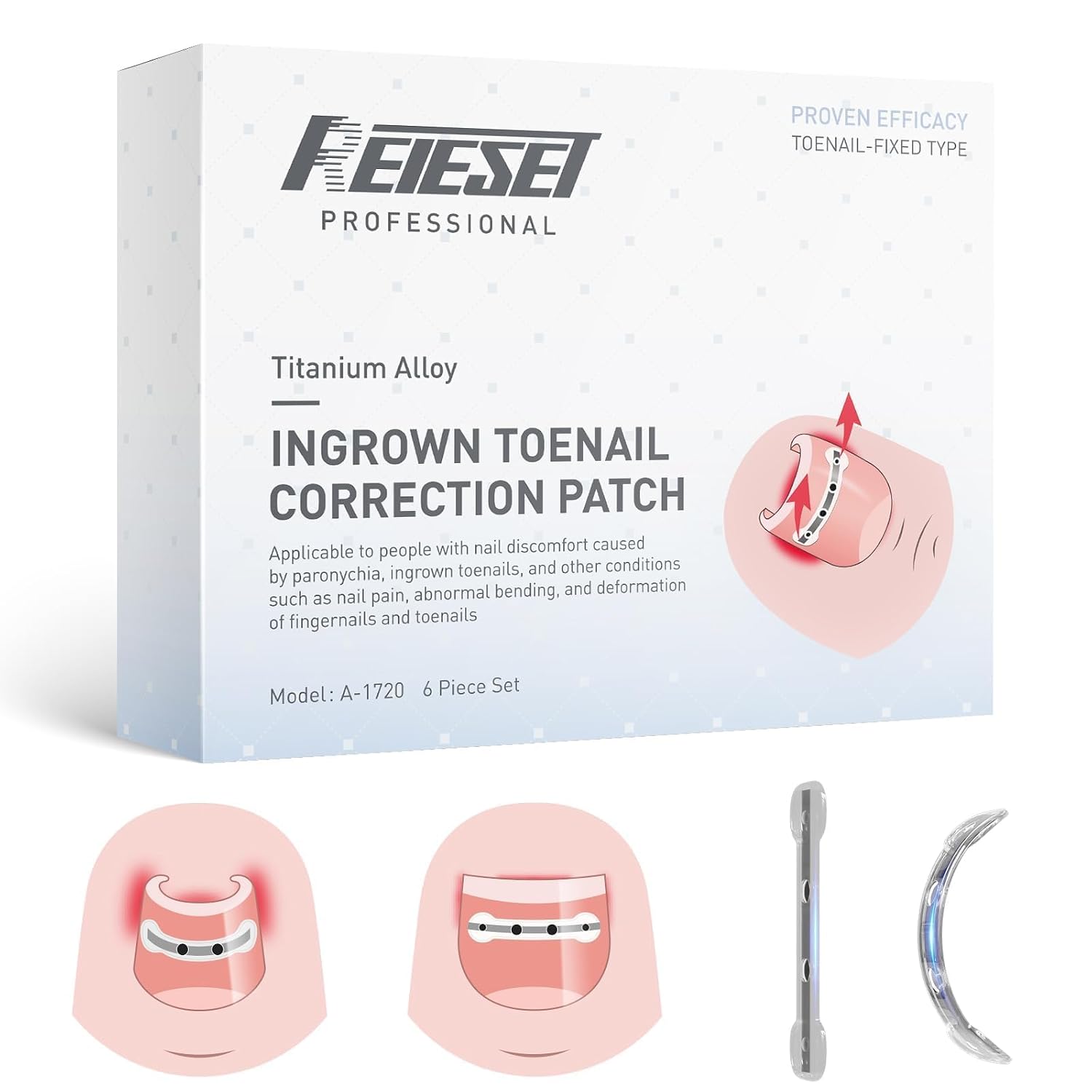 Titanium Alloy Ingrown Toenail Corrector Kit